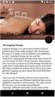 Cupping Therapy And Benefits ảnh chụp màn hình 1