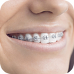 Teeth Braces Photo editor