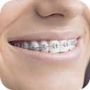 Teeth Braces Photo editor APK