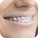 Teeth Braces Photo editor icon