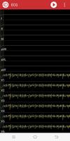 2 Schermata Dr.Cardio - ECG In Your Pocket