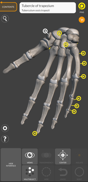 Skeleton screenshot 1