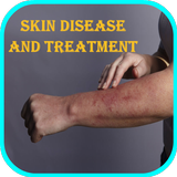 Skin Diseases