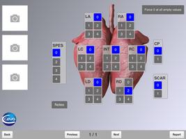 1 Schermata Ceva Lung Program