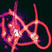 Ebola virus, infected? APK