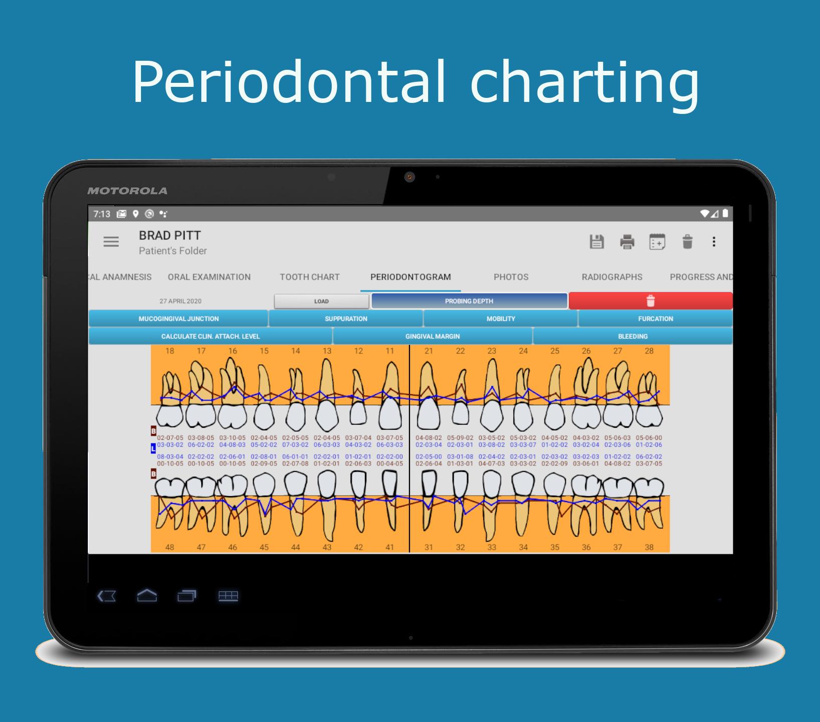 Dental Dental