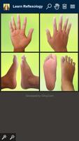 Learn Reflexology Areas โปสเตอร์