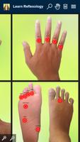 Learn Reflexology Areas ภาพหน้าจอ 2