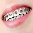 Brackets dentales icono