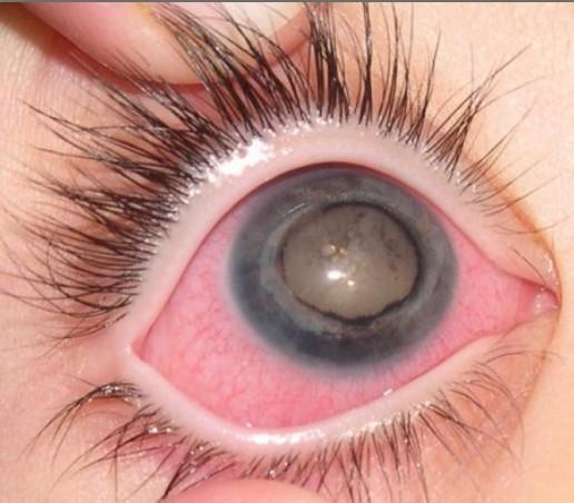 Coloured Contact Lenses For Android Apk Download Coloured Contact Lenses For Android Apk Download