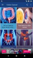 Colon Cancer capture d'écran 1