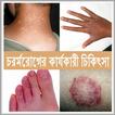চর্ম রোগের কারণ  ও  চিকিৎসা
