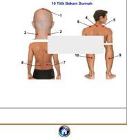 Titik Bekam Sunnah capture d'écran 1