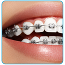 Braces Photo Editor - Beauty e APK