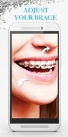 Braces Photo Editor screenshot 2