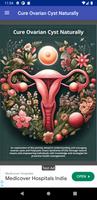 Cure Ovarian Cysts Naturally الملصق