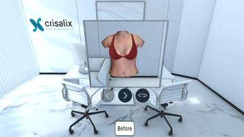 Crisalix VR syot layar 3