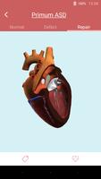 eMurmur Heartpedia स्क्रीनशॉट 2
