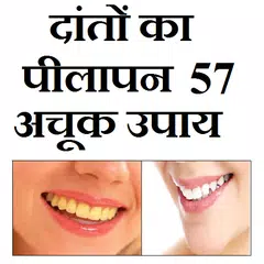 दातो का पीलापन - 57 घरेलू उपाय APK 下載