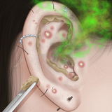 Ear Cleaning Master 아이콘