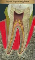 Dental Pain Lite Ekran Görüntüsü 2