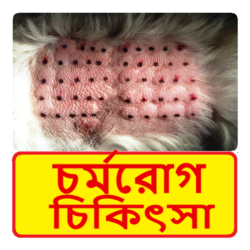 চর্মরোগ চিকিৎসা ~ Dermatitis Treatment