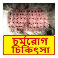 চর্মরোগ চিকিৎসা ~ Dermatitis Treatment APK download