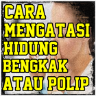 Cara Alami Mengatasi Hidung Be icon