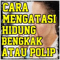 Cara Alami Mengatasi Hidung Be screenshot 2