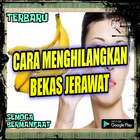 Ramuan Alami Yang Bisa Menghilangkan Bekas Jerawat icono