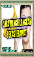 Ramuan Alami Yang Bisa Menghilangkan Bekas Jerawat captura de pantalla 3