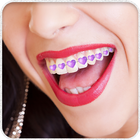 Teeth Braces Photo Booth icône