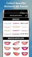 Teeth Braces Photo Booth capture d'écran 1