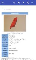 المعادن تصوير الشاشة 1
