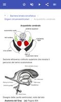 3 Schermata Cervello