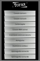 Radiografias de examenes capture d'écran 2