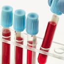 Blood Test Results APK