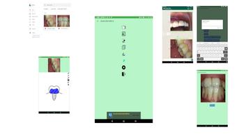 Dental USB CAM free постер