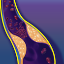 Int. VTE & Cancer Guidelines APK