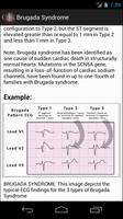 ECGsource screenshot 2