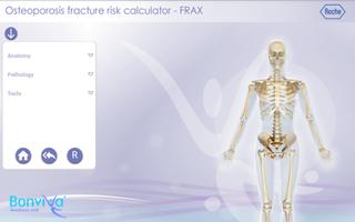 FRAX calculator Bonviva Affiche