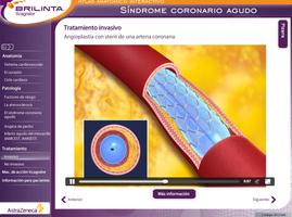 Síndrome Coronario Agudo captura de pantalla 1