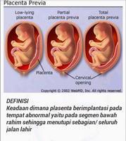 Asuhan Keperawatan capture d'écran 3