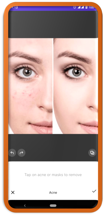 Facetune Editor-Smooth skin poster