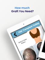 Hair Transplant Turkey Affiche