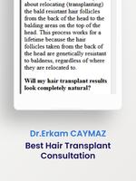Hair Transplant Turkey capture d'écran 3