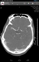 Synapse ảnh chụp màn hình 2