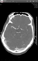 Synapse ảnh chụp màn hình 3