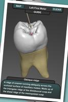 Real Tooth Morphology capture d'écran 2
