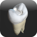 CavSim : Dental Cavity Trial APK